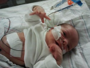 Beren a few days after surgery.  Middle name: Lewis.  It means Famous in Battle, named after my grandfather.  He earned his name.