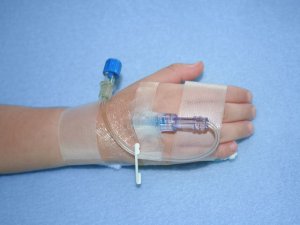 ivh-child-hand-iv-set-up-2